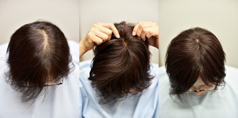 分け目にポン装着の流れ